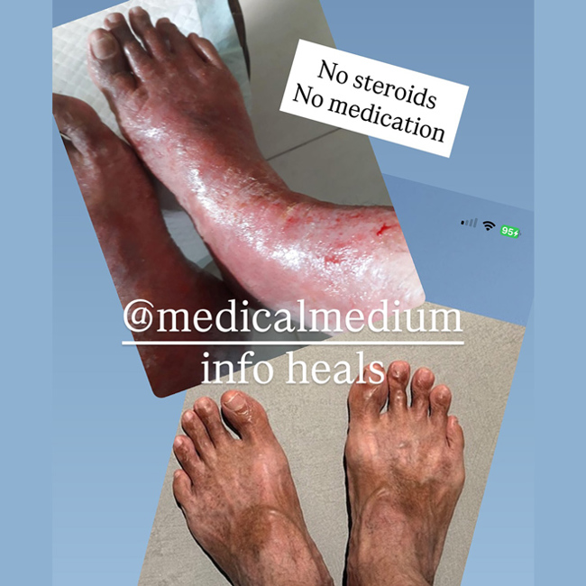 9 Months In & My Dad’s Blood Sugar Numbers Have Improved